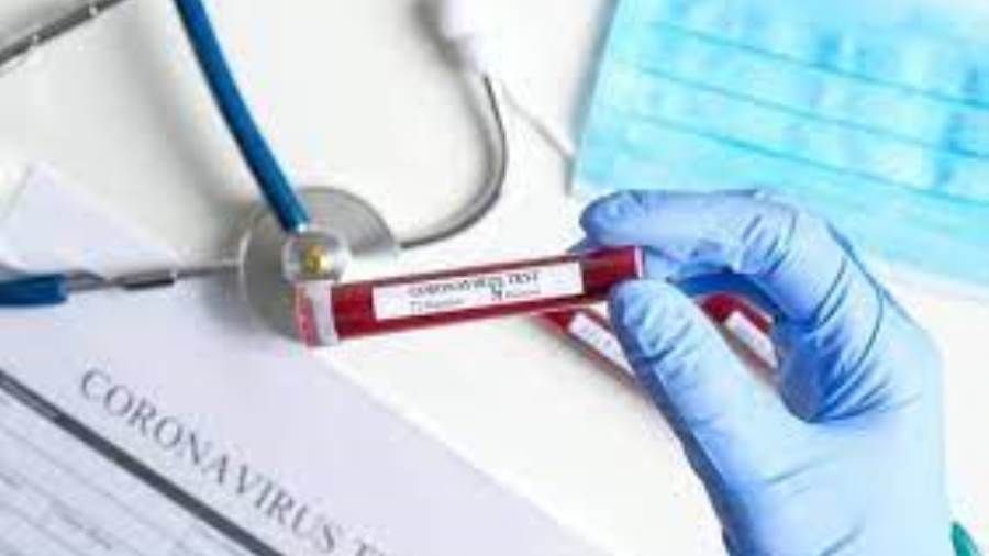 311 إصابة جديدة بـ" كورونا" و3 وفيات في فلسطين