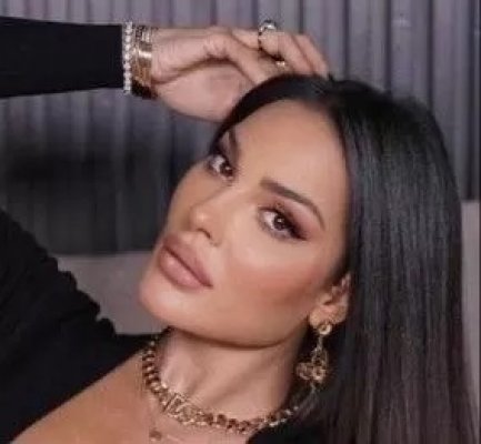 بلباس شفاف دون بنطال .. نادين نجيم تخضع لعملية نفخ خلفيتها وهي تصرخ ألماً وتوثق بالفيديو ..شوف دلوقتي