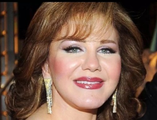 وجه ميادة الحناوي ارعب الجميع والجمهور مستاء وغضبان من تداول صورها وهي بهذا الشكل.. ماذا حدث لها؟كيف تحولت لمسخ