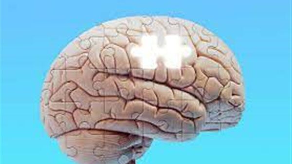 دراسة تكشف ارتباط مرض ألزهايمر عند النساء بالكروموسوم X.. ماذا أظهرت؟