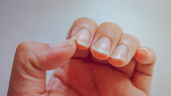 لماذا السبب يعاني مرضى السكري من "إصبع الزناد"؟