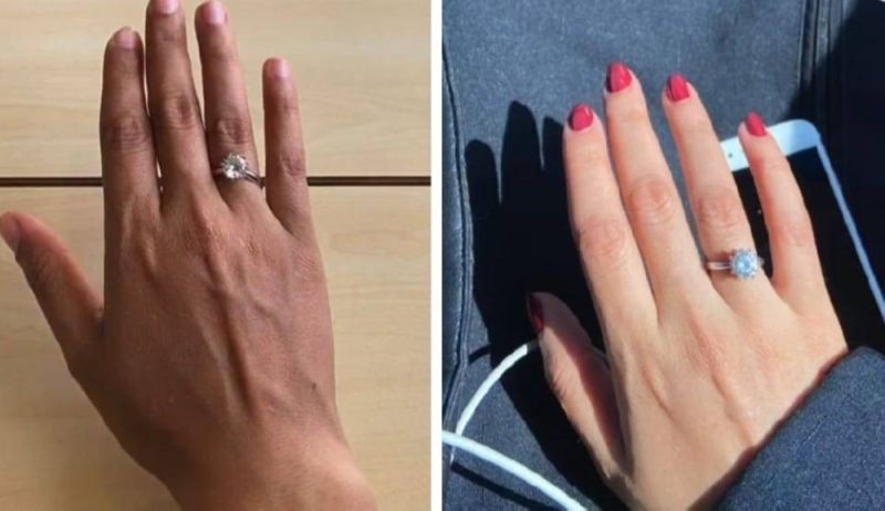 فتاة سعودية توثق فيديو صادم لتغير لون يدها قبل وبعد الدورة العسكرية..(فيديو)