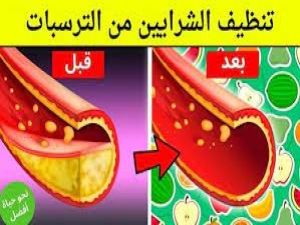 ستخرج من شراينك دهــون ملتـصقة ومتراكمة لم تخرج من سنوات ملعقة تنظيف الشــرايين ستنعش قلبك