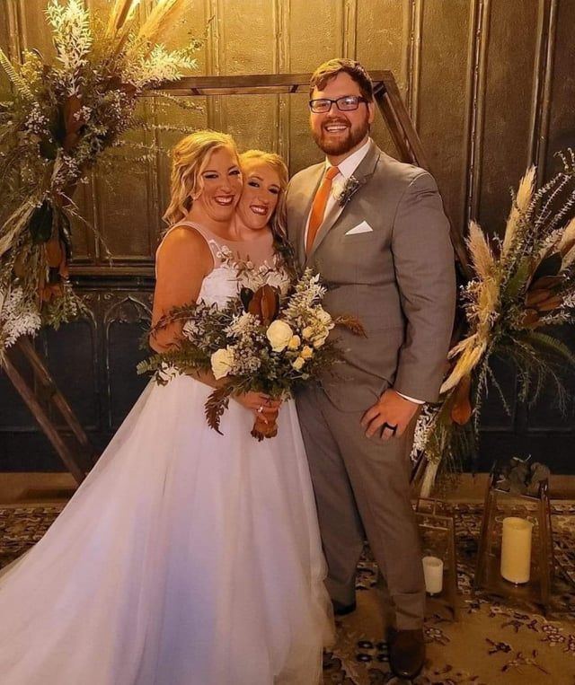 بعد فترة من السرية.. الكشف عن زواج أشهر توأم في العالم (فيديو)