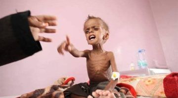 استشهاد أربعة فلسطينيين جراء سوء التغذية والجفاف في غزة