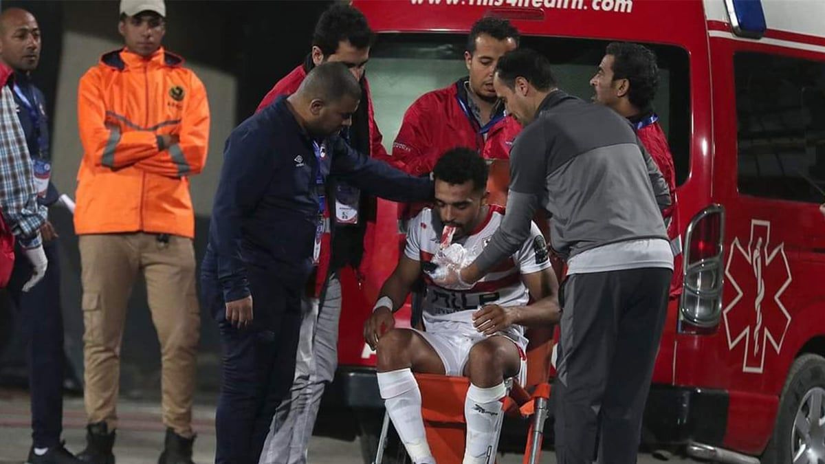 إصابة لاعب الزمالك بكسر في الفك