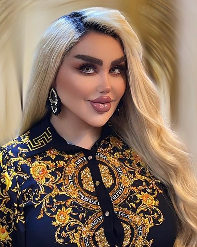 بسبب جراحات التجميل.. إعلامية عراقية تتصدر الصحف العالمية (صور)