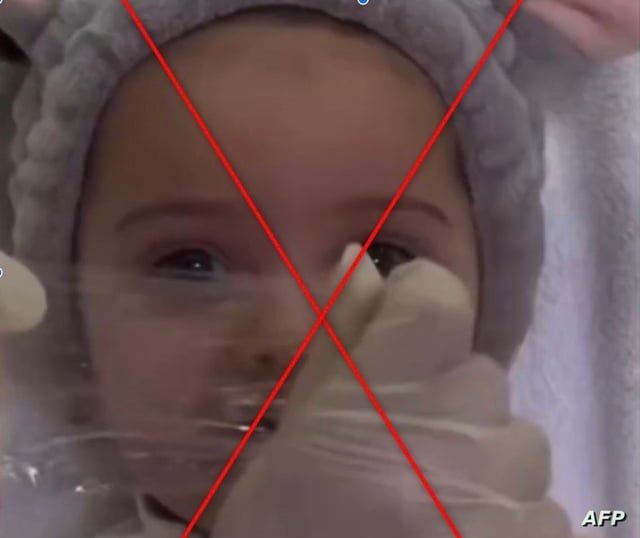 فيديو لتكبير شفاه طفلة في عيادة تجميل يثير غضبا.. فما قصته؟