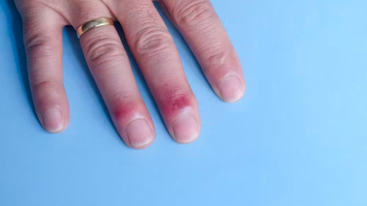 بشرتك أداة تشخيصية فعالة لصحتك