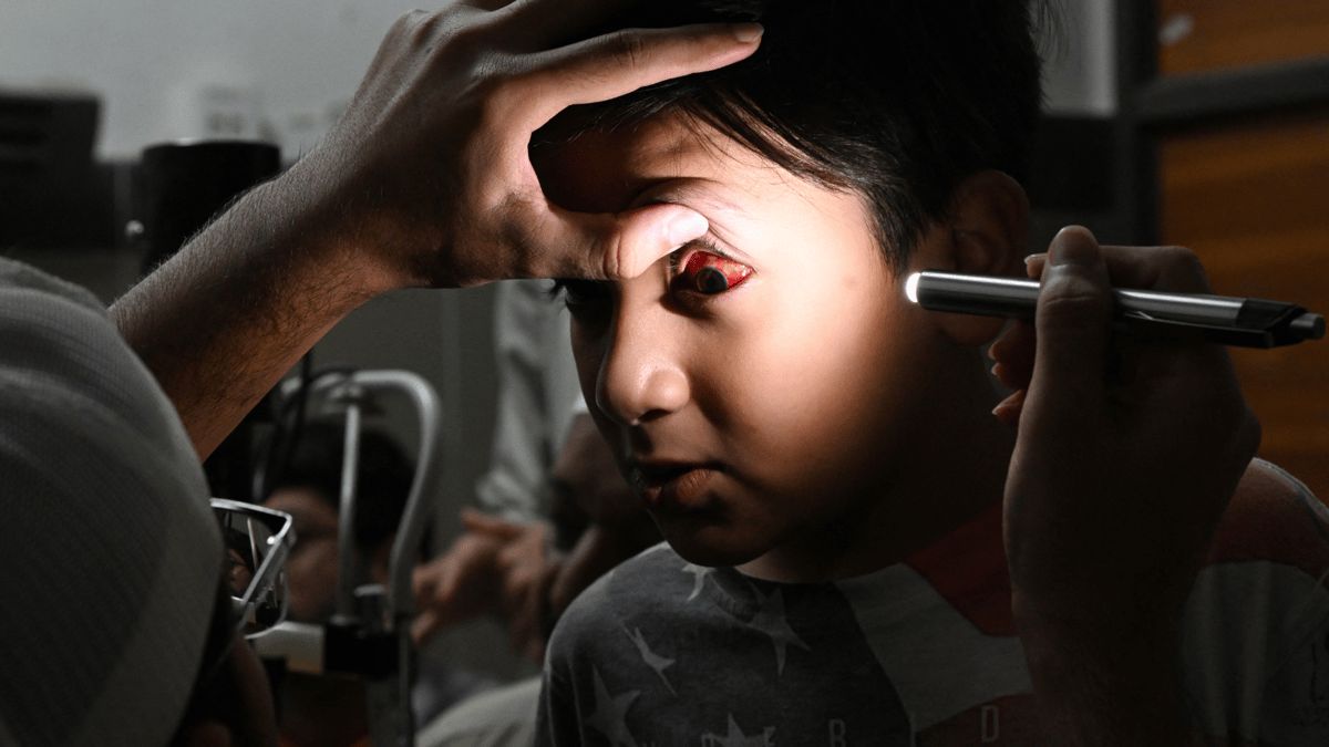 ما مدى خطورة احمرار العين؟