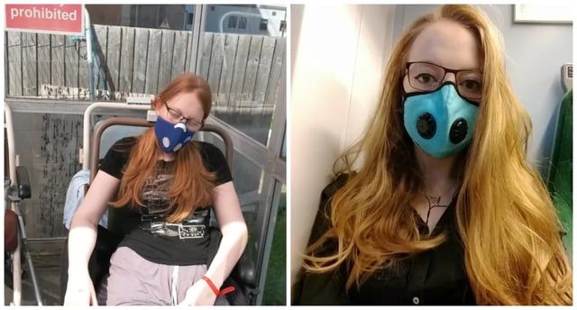 متلازمة نادرة تحرم شابة من تناول الطعام (صور)