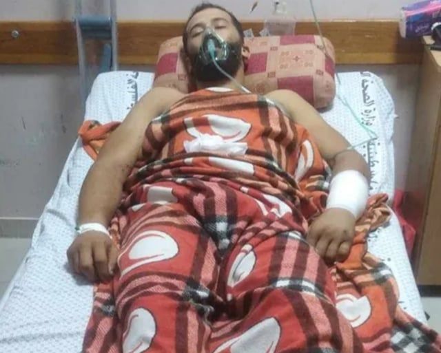 غادر شمال غزة بقدم واحدة.. أحمد أبو شرخ يروي مأساته مع النزوح (صور)