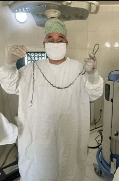 كادت أن تقتلها.. اكتشاف خصلة شعر طويلة في دماغ طفلة (صور)