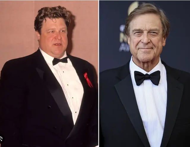 تحذيرات طبية من "وجه أوزيمبك" الذي يجتاح هوليوود (صور)