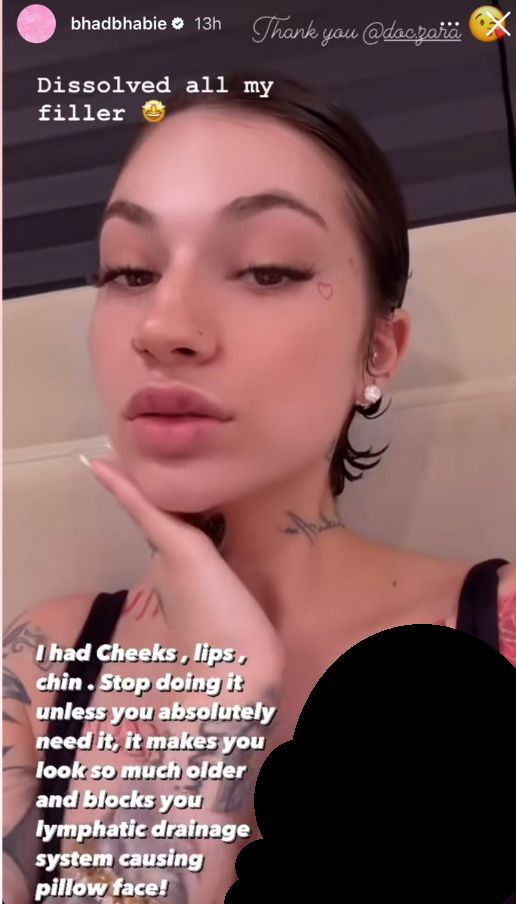 مغنية شهيرة تزيل "حشوات التجميل" من وجهها وتحذر جمهورها