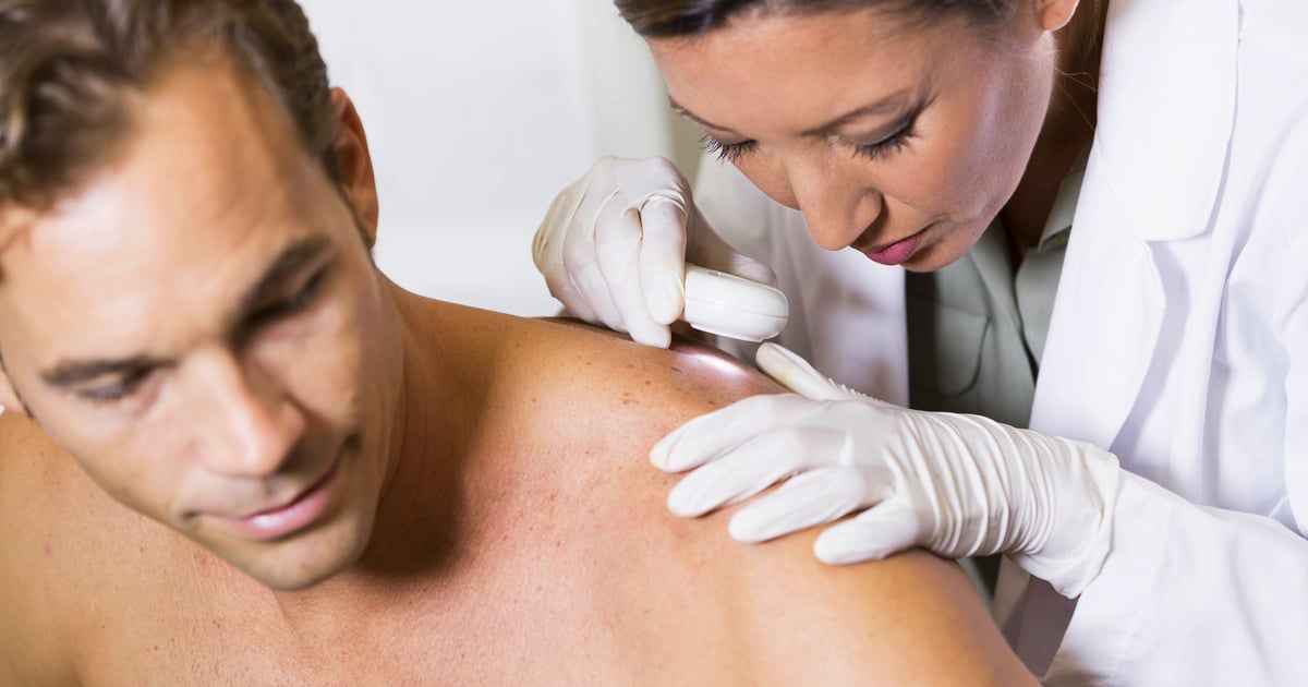 5 علامات تحذيرية تدل على الإصابة بسرطان الجلد