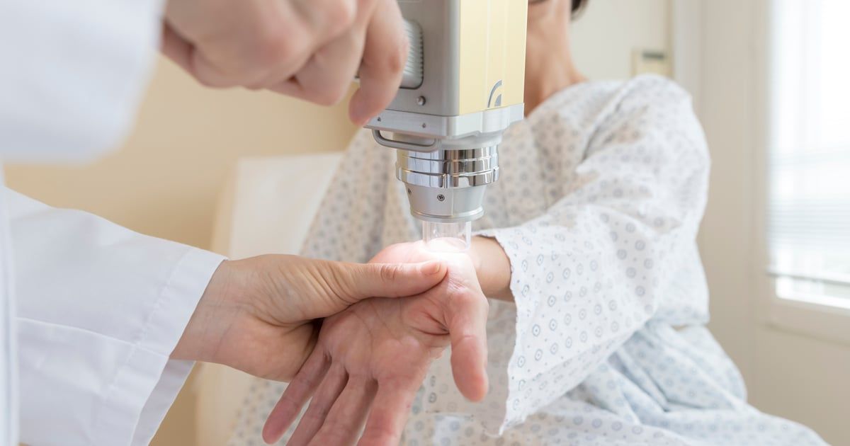 معدلات الإصابة بسرطان الجلد تبلغ أعلى مستوياتها في بريطانيا