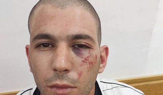 اتهام ضباط إسرائيليين بوسم فلسطيني بـ"نجمة داود" (صورة)