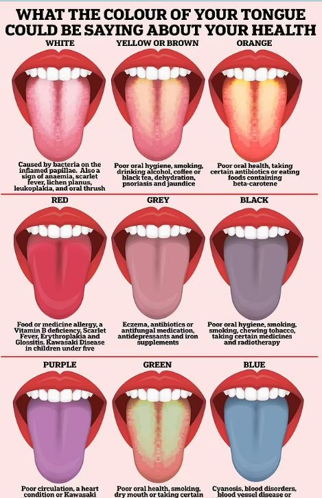 لون لسانك يكشف خفايا عن صحتك