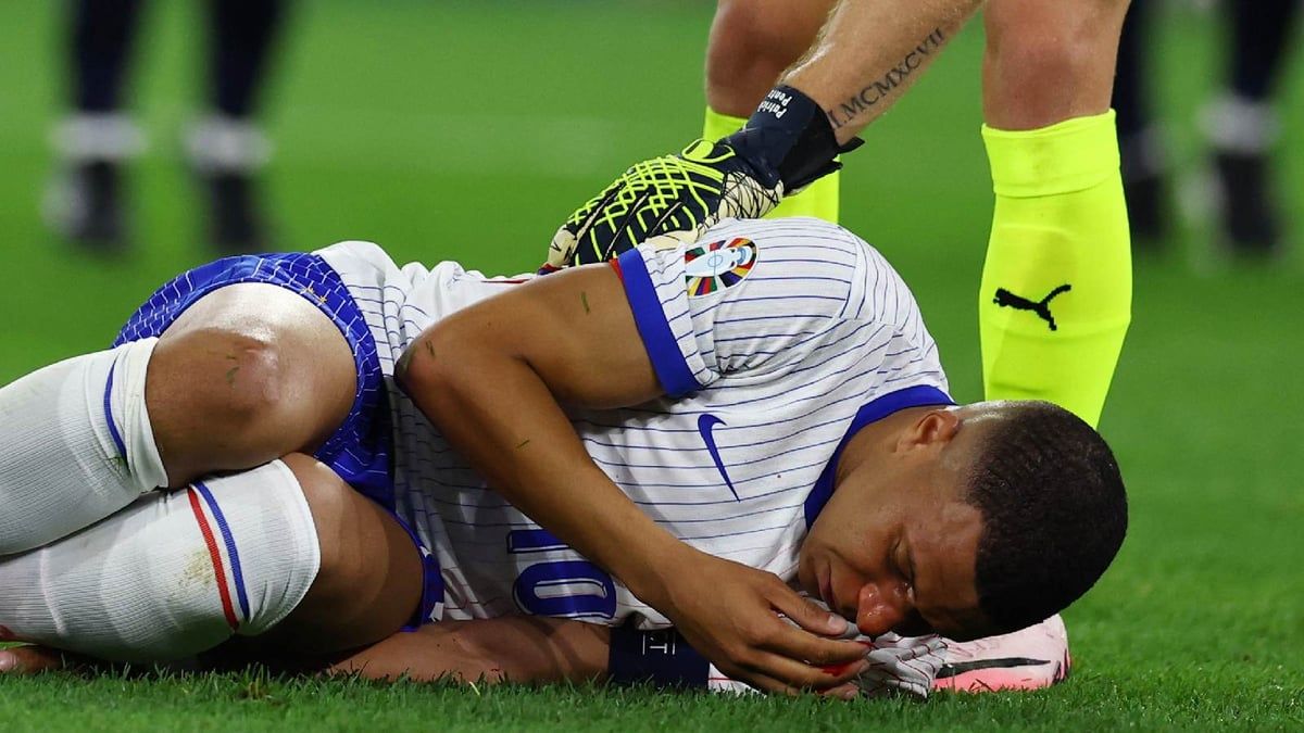 لحظة إصابة مبابي القوية في الأنف (فيديو وصور)