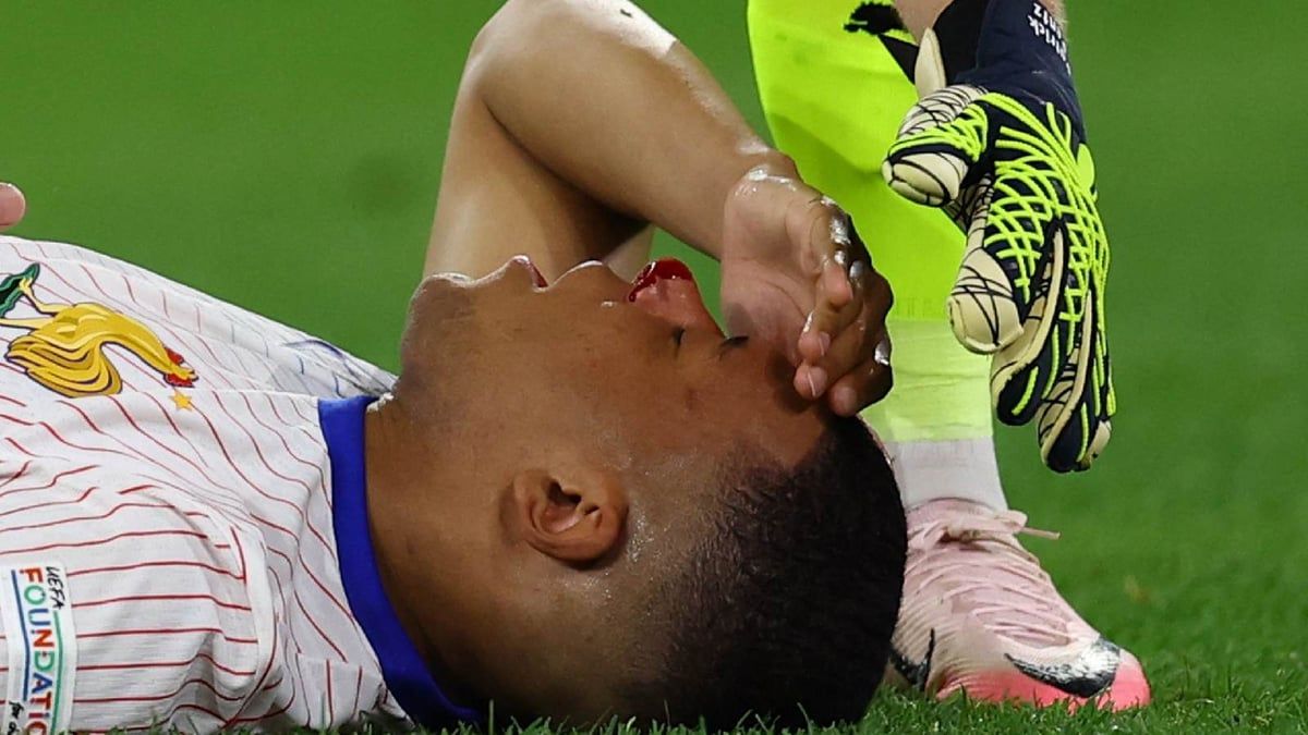 مرتديا قناع.. هكذا سيظهر مبابي في بقية مباريات يورو 2024 (صورة)