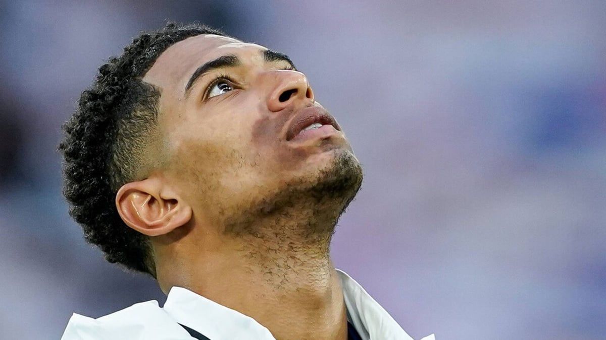 سبب البقع السوداء في وجه بيلينغهام (صور)