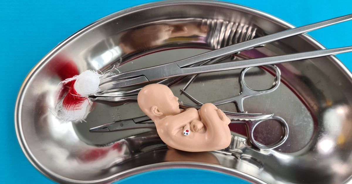 مصر.. تصريحات "صادمة" لطبيب حوّل عيادته لوكر عمليات إجهاض