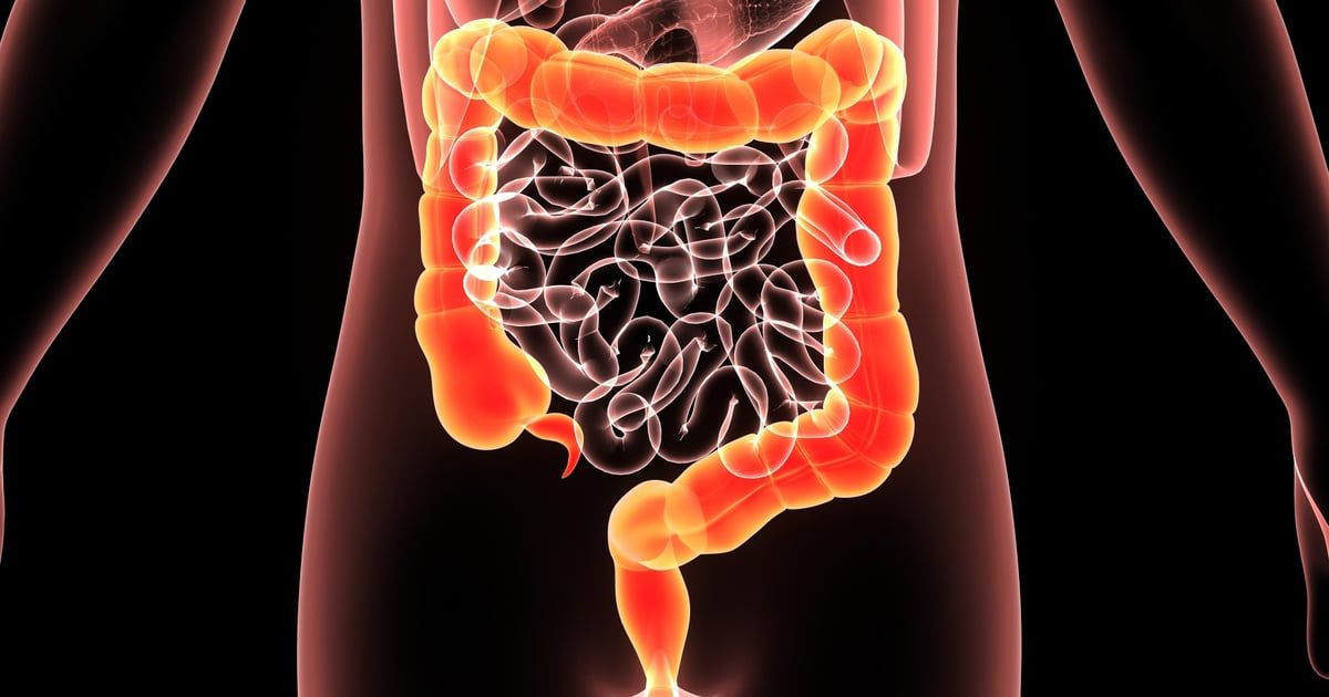 علماء يكتشفون السبب الرئيس لداء الأمعاء الالتهابي