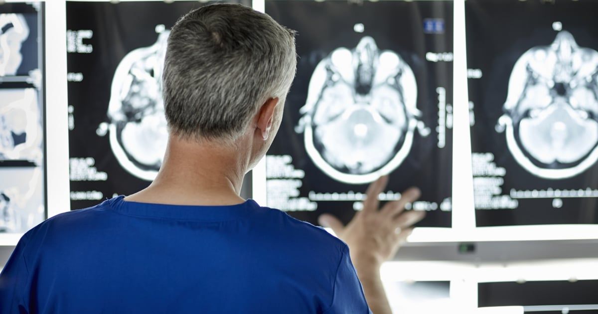 الذكاء الاصطناعي يحلل الكلام للتنبؤ بمرض الزهايمر