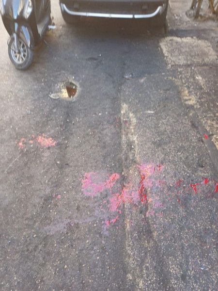 شاهد: إصابة المئات من عناصر (حزب الله) اللبناني بانفجار أجهزة اتصال يحملونها - موقع الخليج الان