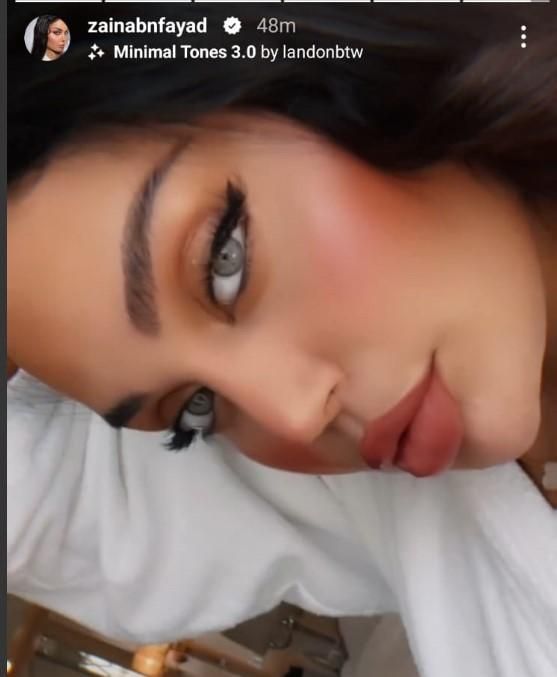 بالصور: بشفاه منتفخة.. ابنة هيفا وهبي تُثير الجدل بآخر إطلالة لها شاهدوا كيف بدت