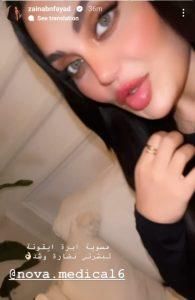 أطلت بشفاه منتفخة.. ابنة هيفا وهبي تكشف عن عمليات التجميل التي قامت بها (صور)