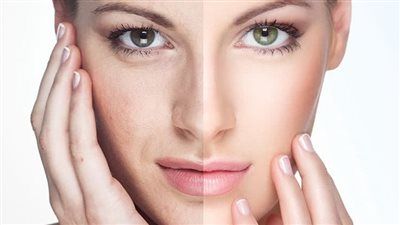 3 حركات يومية تنقذ وجهك من الترهل.. ثورة تجميل طبيعية بدون جراحة أو بوتوكس - الخليج الان