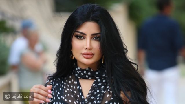 ملكة كابلي توثق إزالتها لفيلر الشفايف والتكلفة تصدم الجمهور