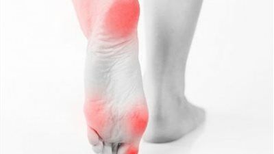 ثقل الساقين في الصيف.. الأسباب وطرق الوقاية والعلاج - الخليج الان