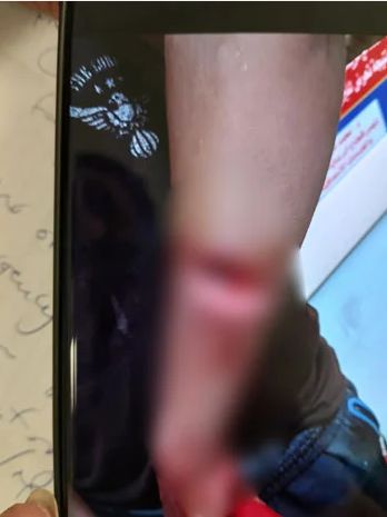 مطاردة بلطجي اعتدى على طالب حاول حماية أطفال من بطشه بالجيزة - الخليج الان