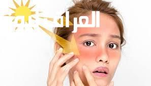 الشمس هتحرقك لو مافعلتش.. نصائح لحماية البشرة من الشمس الصيفية خليك واعي ومتنساش الكريم