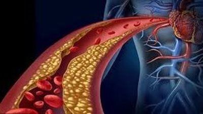 5 فواكه تقاوم الكولسترول وتعزز صحة القلب - الخليج الان