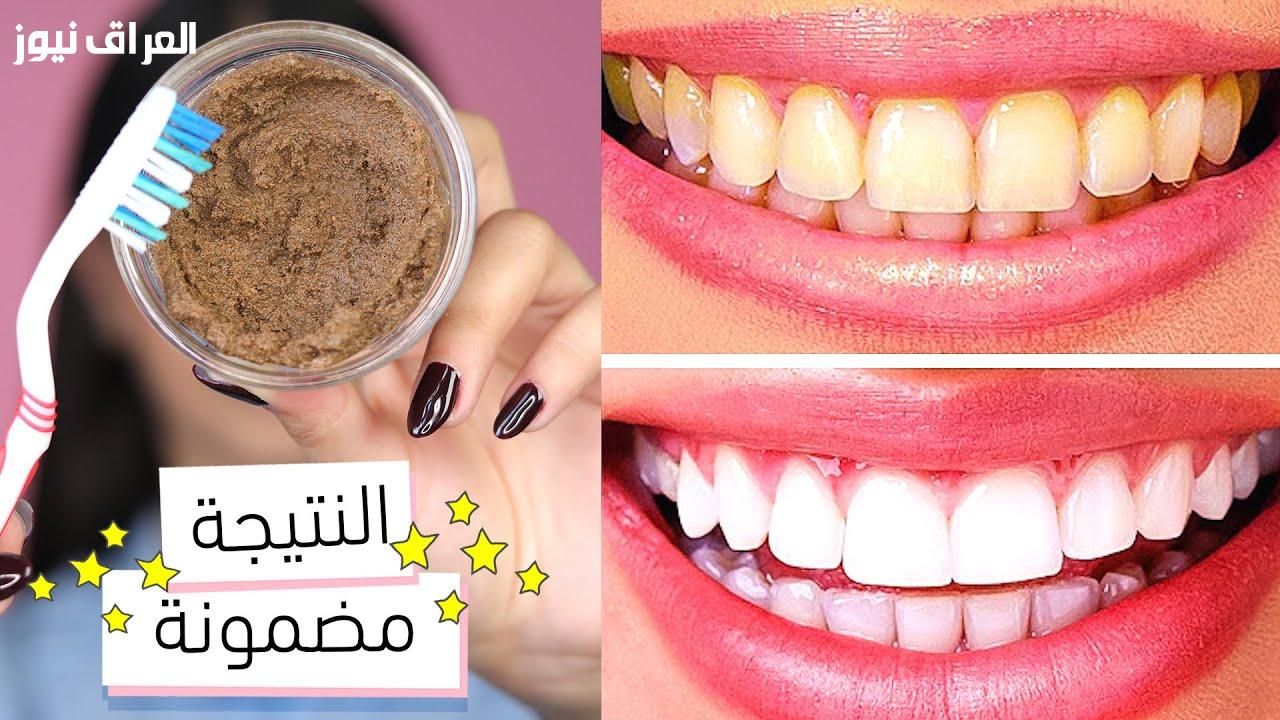 من غير كيماويات ولا وجع خلطات طبيعية تبيض الأسنان بأمان