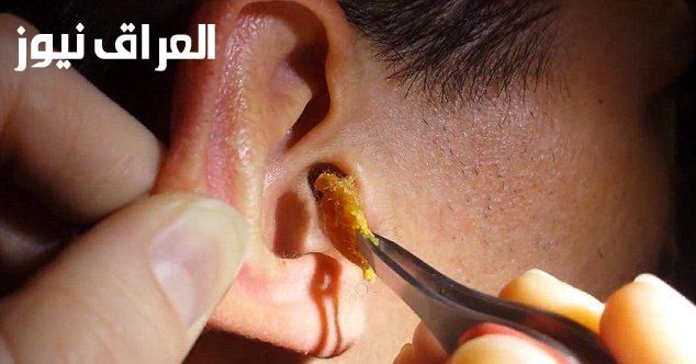 ولا دكتور ولا قطرات .. طريقة مجربة تشيل شمع الأذن بسهولة ومن غير ألم 