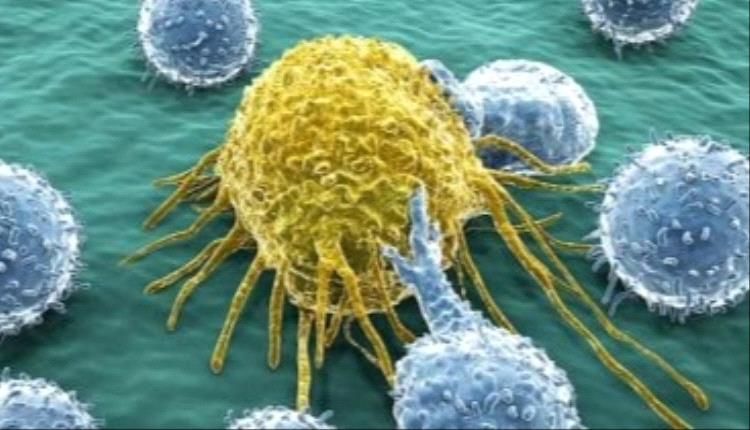 4 علامات تحذيرية خفية تكشف الإصابة بالسرطان