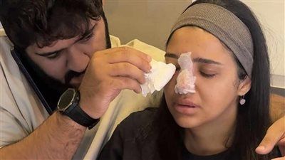 كنزي مدبولي تتعرض لخطأ طبي: مناخيري كانت هتروح بسبب حقنة فيلر - الخليج الان