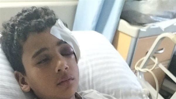 إصابة صغير بكسر في الجمجمة وتهتك بالفك إثر رشقه بالحجارة خلال ركوبه قطارًا بالمنوفية | بث مباشر