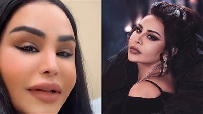 أحلام تكشف تفاصيل عملية تجميل أنفها: سعيدة بالنتيجة بعد 3 أشهر - الخليج الان