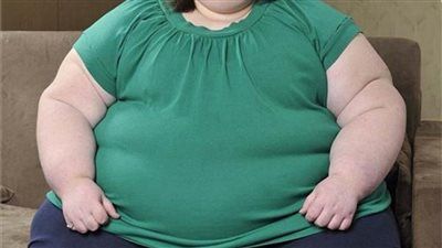 هل العالم على أعتاب«ثورة علاجية للسمنة والسكر النوع الثاني»؟ - الخليج الان