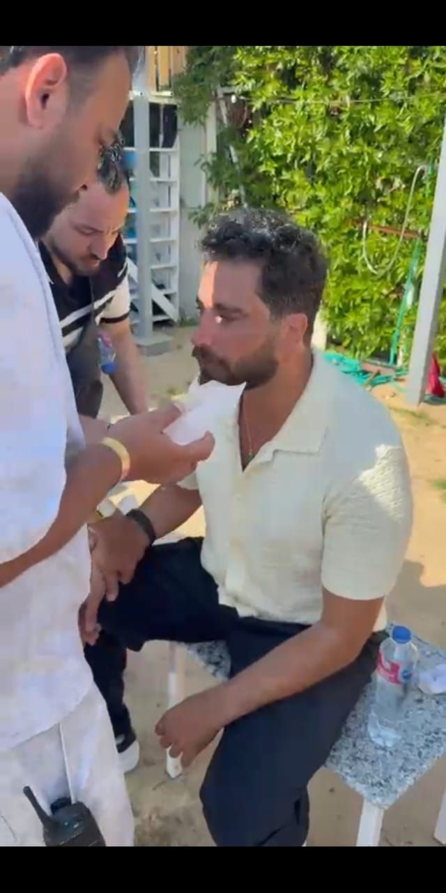 تعرض معتصم النهار لإصابة بالوجه خلال تصوير فيلم نصيب بطولة ياسمين صبري - الخليج الان