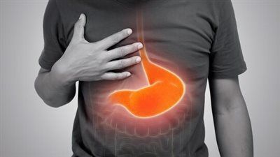 15 علاجًا منزليًا طبيعيًا للحموضة وارتجاع المريء وحرقة المعدة - الخليج الان