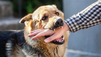بخطوات بسيطة.. كيف تحمي نفسك فور التعرض لعضة كلب؟ - الخليج الان
