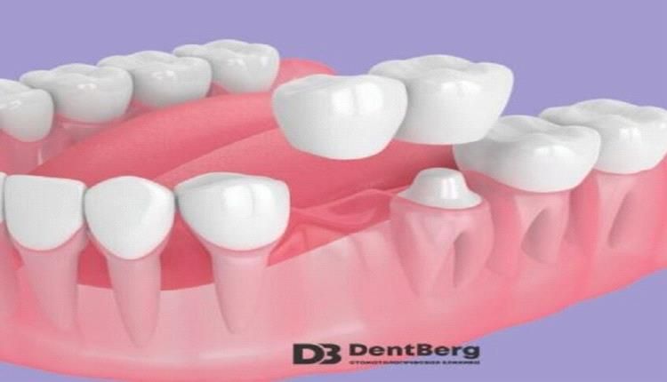 اكتشاف جديد يصنع ثورة في طب الأسنان !