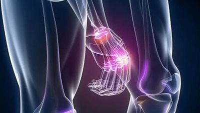 أسباب وأعراض التهاب المفاصل.. الحل الطبي الفعّال لحماية الحركة من التآكل - الخليج الان